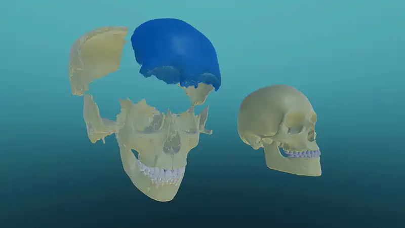 The skull